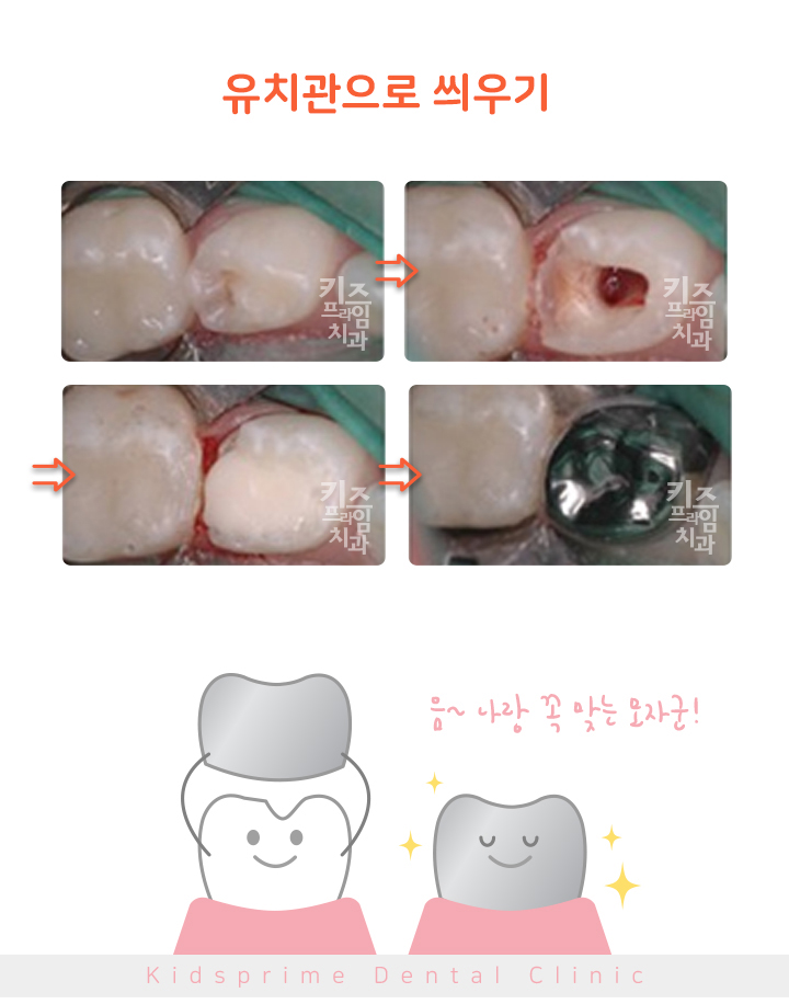 키즈프라임  