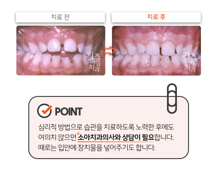 키즈프라임  