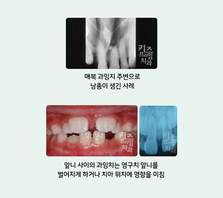 키즈프라임  