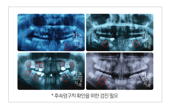 키즈프라임  