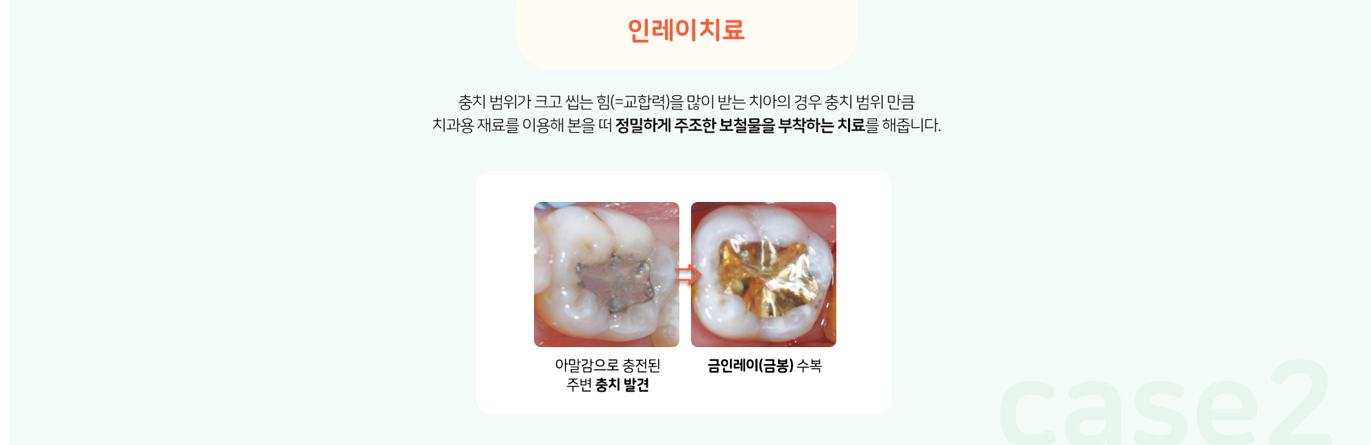 키즈프라임 