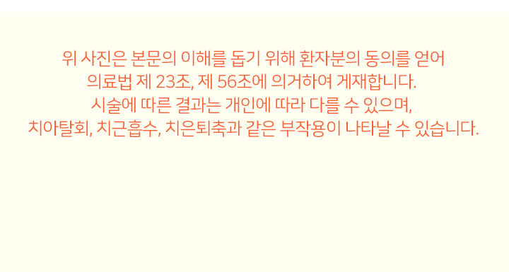 턱교정 