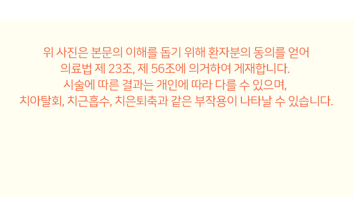 턱교정 